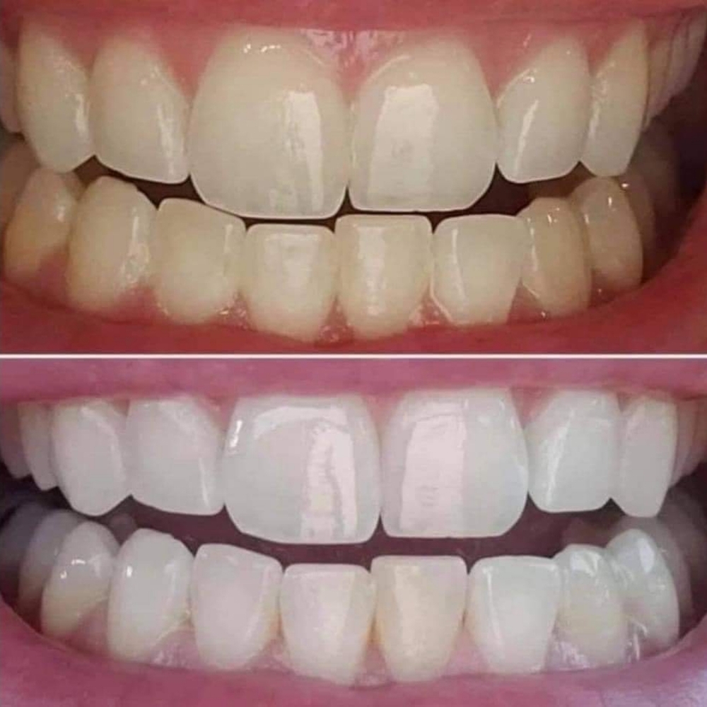 NuSkin AP 24 Whitening Toothpaste Bundle of 2